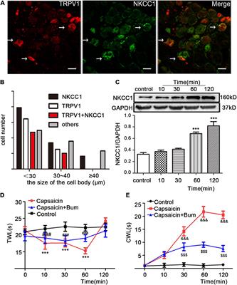 Improving NKCC1 Function Increases the Excitability of DRG Neurons Exacerbating Pain Induced After TRPV1 Activation of Primary Sensory Neurons